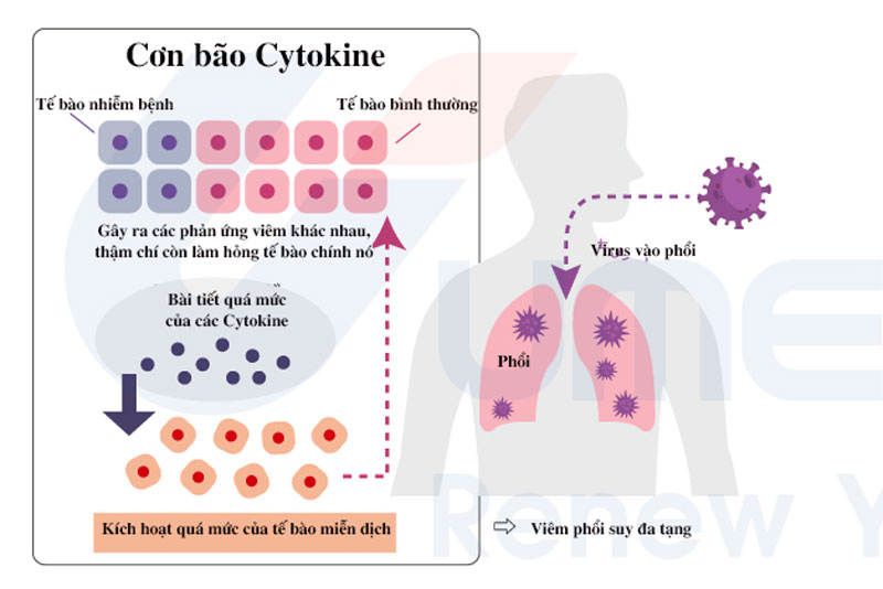 Cúm trầm trọng hơn với cơn bão cytokine